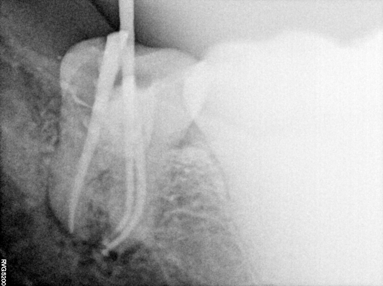 Dental X-ray